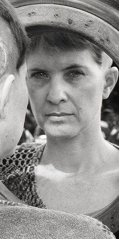 Head scars by photogorapher Andrew Worrsam, of Andrew Woorsam photograpy, after my second operation.