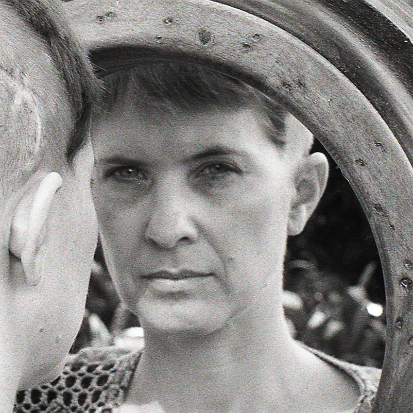 Anne Howell and her scars, to some degree visible, from the second operation